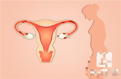 子宫脱垂会影响怀孕吗？