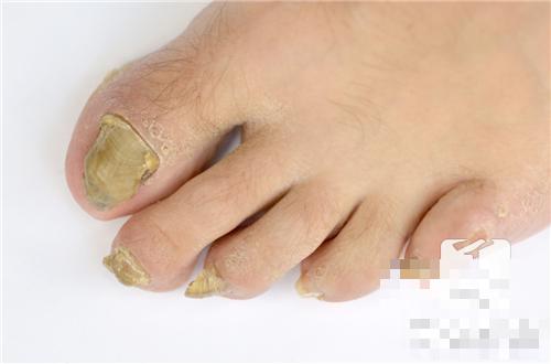 指甲隐隐作痛的原因是什么？
