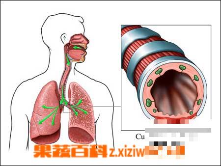 小孩支气管炎食疗方法 小孩支气管炎吃什么食物好