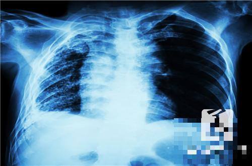 肺部活检和穿刺的区别是什么？
