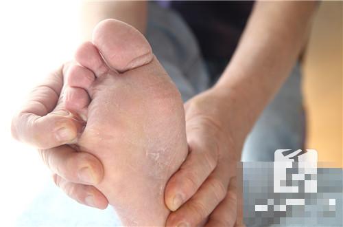 脚气感染到手上有何症状？