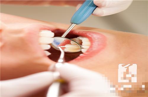 牙槽骨吸收如何治疗？