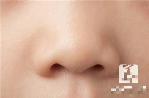 缩鼻头鼻翼手术，你知道该手术怎么做吗？
