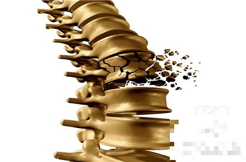 腰椎变形压迫神经都有哪些危害？