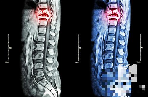 脊梁骨中间疼是什么原因