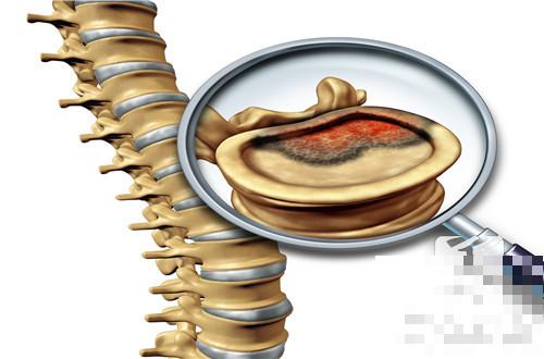 脊梁骨中间疼是什么原因