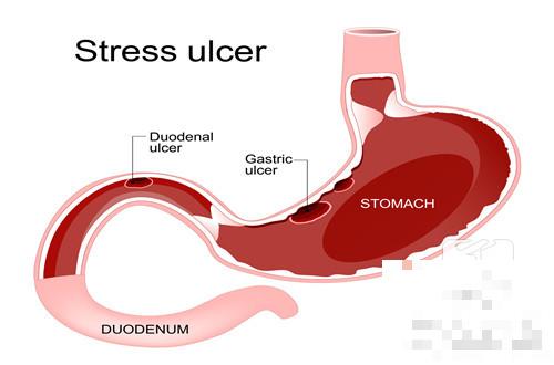 验证胃管在胃内的三种方法
