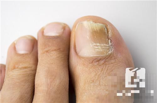 脚指尖刺痛是什么原因