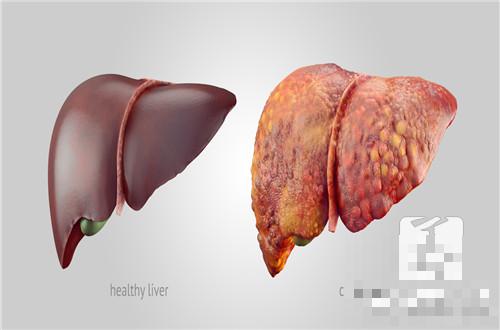 肝脏弥漫病变是什么意思
