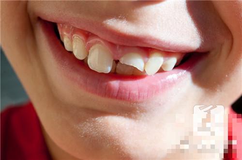 牙龈出血的治疗方法是什么？