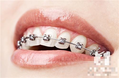 牙龈肿痛吃什么好？专家推荐这7种！